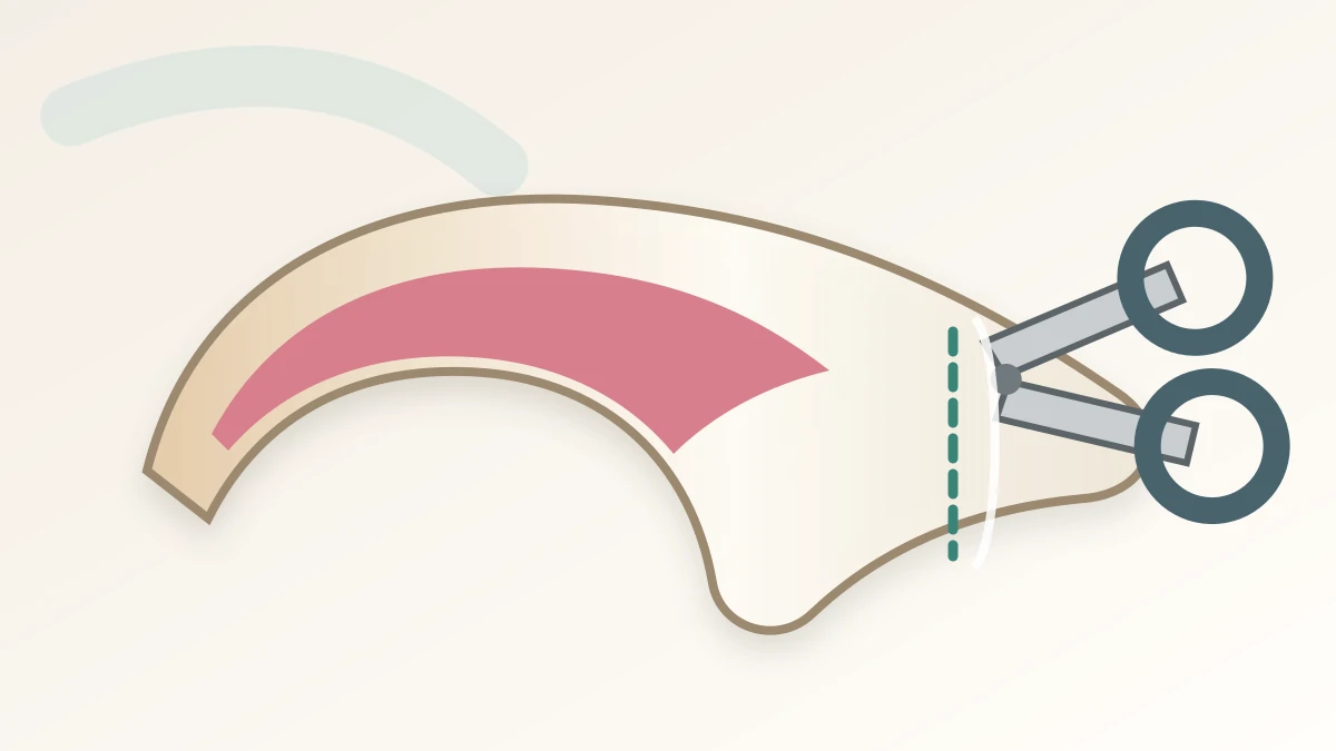 Caregiver making one conservative cut on the clear tip of a pale cat claw while staying well ahead of the visible quick